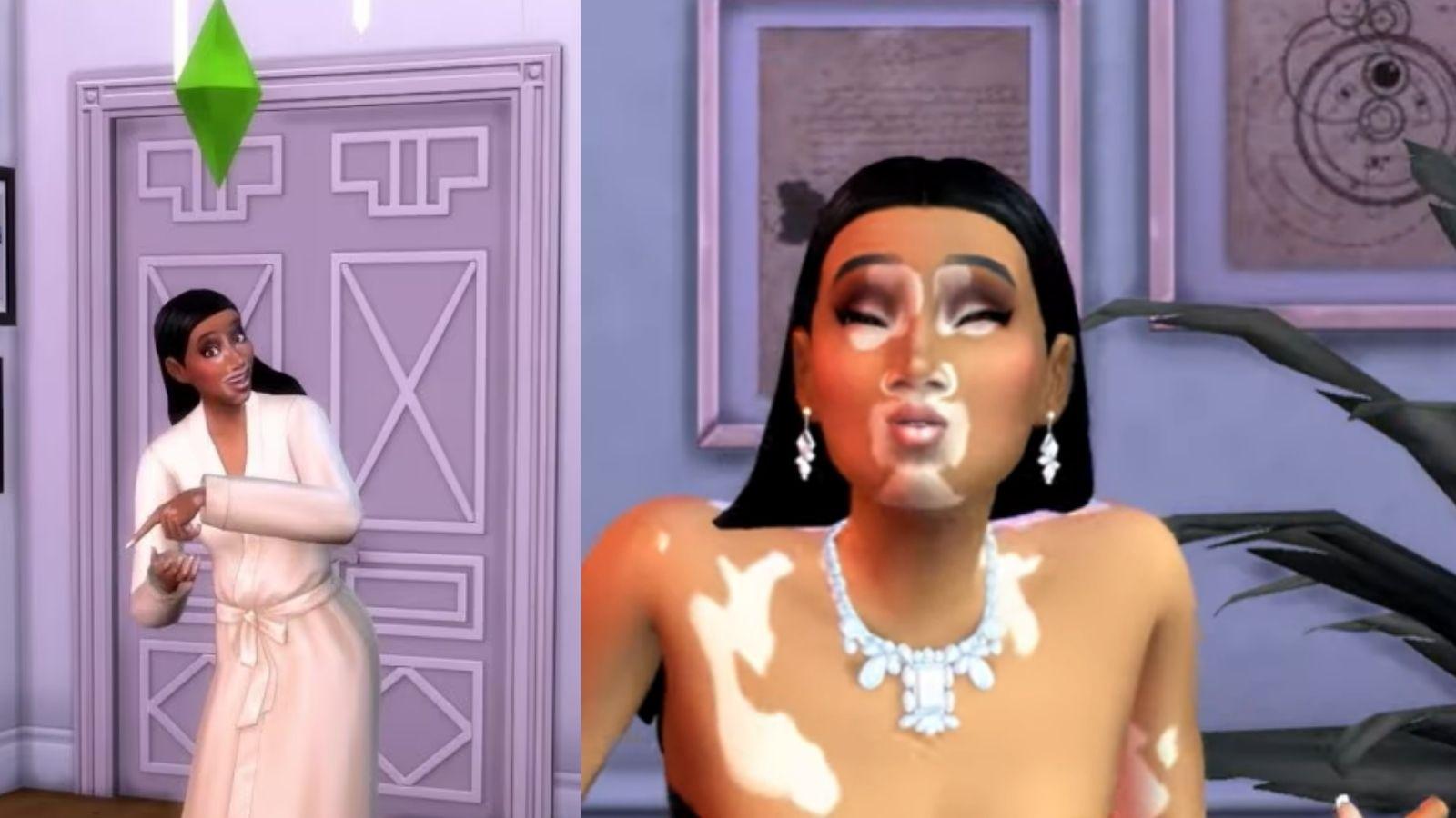 Sims 4'te Vitiligo Adıyla Yeni Güncelleme Duyuruldu